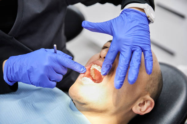 Best Emergency Wisdom Teeth Removal in Kalamazoo, MI
